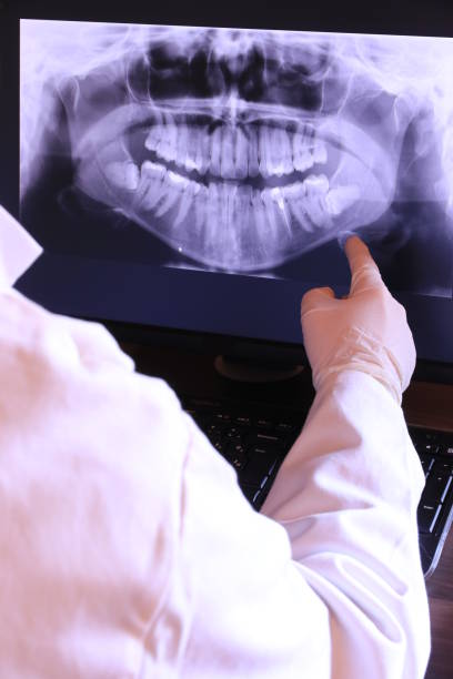 Best Emergency Treatment for Dental Infections or Abscesses in Fort Polk South, LA